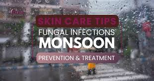 Tinea During Monsoon Season