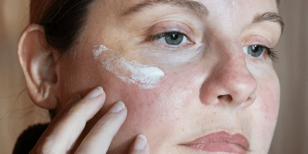 Azelaic acid